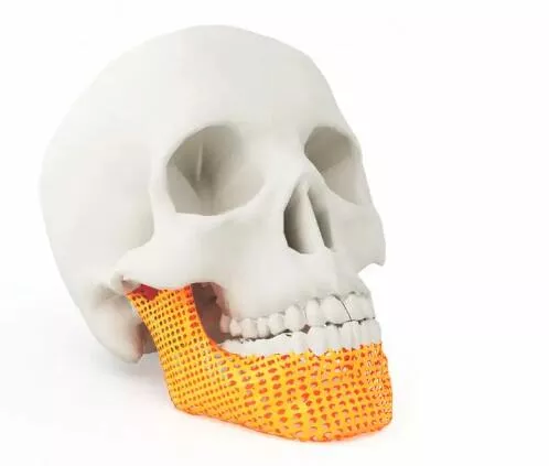 Can Zirconia Ceramic Beads for Grinding be Used in the Production of Artificial Bones?